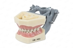 760 Pedodontic Soft Gingival Model with Removable Teeth, Six-Year Molars and ULB